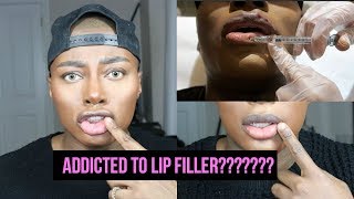 Lip Fillers with Flawless Cosmetic
