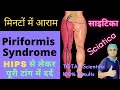 Sciatica Dard Kaise Theek Kare साइटिका दर्द का इलाज Piriformis Syn