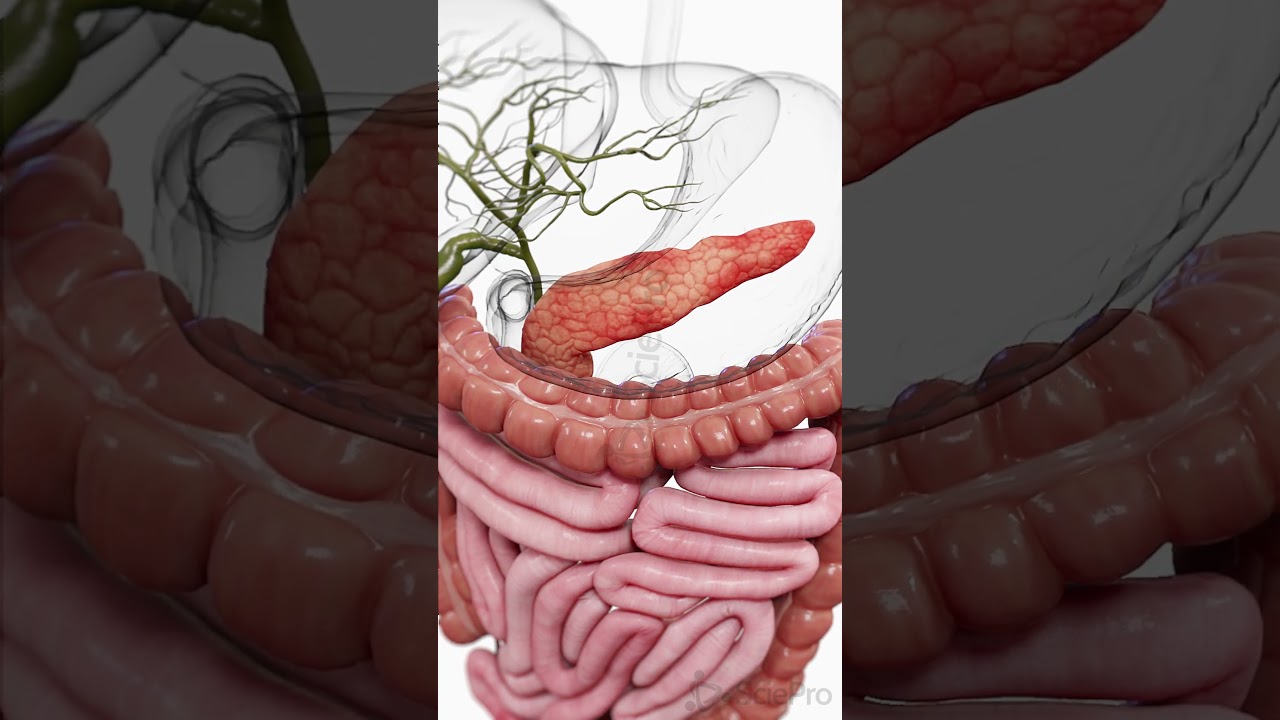 🔥 Pancreatitis: When the Pancreas Turns Against Itself 🔥  #medicalanimation #anatomy