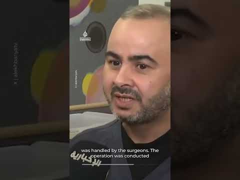 Conjoined twins separated after surgery in Saudi Arabia | AJ #shorts