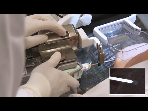 Contrast Biopsy Pristina and EnCor Enspire - BD Europe