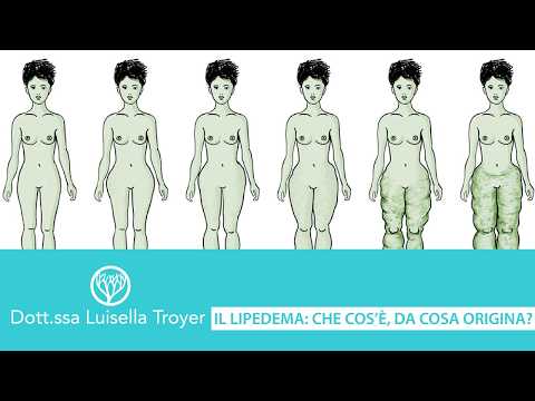 Luisella Troyer-454