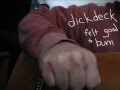 DickDeck - Felt Good to Burn