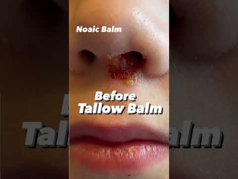 Customer video