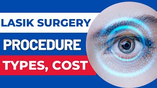लेसिक सर्जरी | Lasik Laser Eye Surgery: Procedure, Type, Cost | Femto, Contoura, Smile