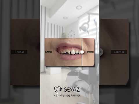 Klinik videolarımızı izleyin