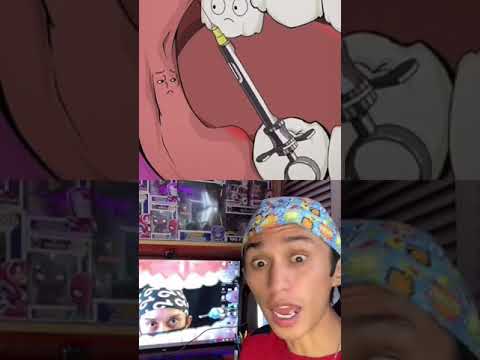 how wisdom teeth are extracted