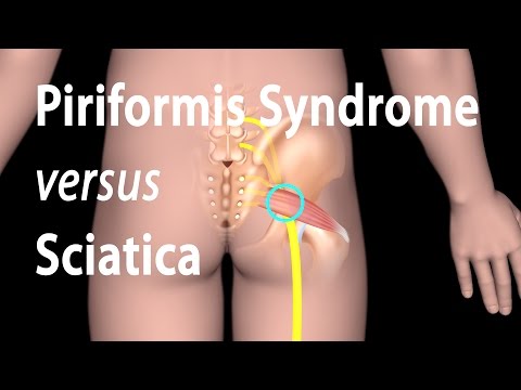Overview of the Musculoskeletal System Animation