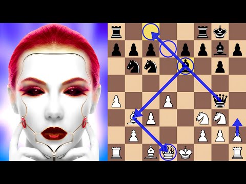 Leela Breaks Stockfish's Modern Alekhine