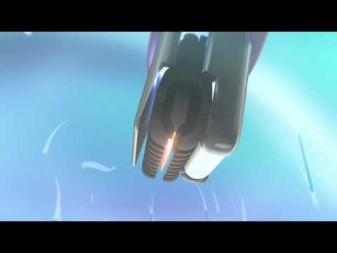 How the no!no! 8800 works to remove and treat hair