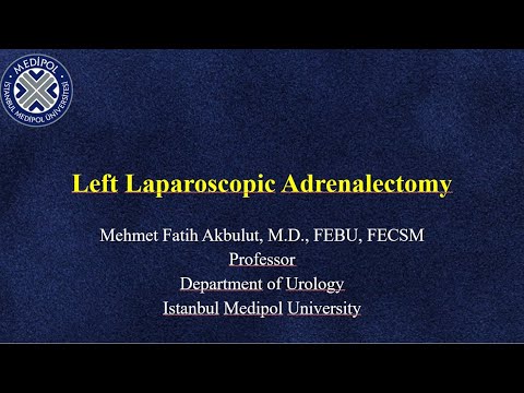Conn Syndrome Laparoscopic Left Adrenalectomy Full Video