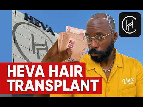 I FINALLY GOT A HAIR TRANSPLANT- HEVA CLINIC- TO ISTANBUL TURKEY