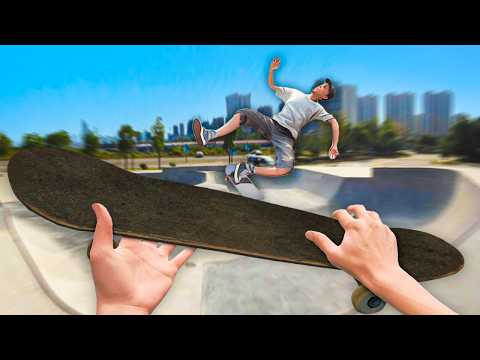 I Was Hospitalized While Skateboarding