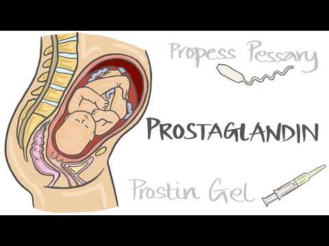 Hormonal methods of induction