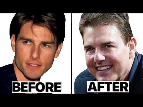 Tom Cruise’s Face: Natural or Surgical? Plastic Surgeons React!