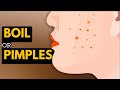 Boils Vs Pimples What S The Difference And How To Treat Them
