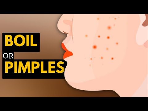 All About Allergy Shots