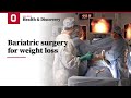 Bariatric surgery for weight loss | Ohio State Medical Center