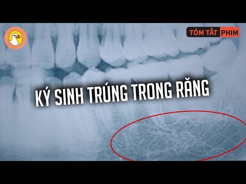 Ký Sinh Trùng Trong RĂNG - Khiến Người Nhiễm Hóa Thành Thây Ma |Quạc Review Phim|