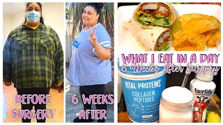 WHAT I EAT IN A DAY AFTER 6 WEEKS OF HAVING GASTRIC BYPASS SURGERY // HOW MUCH WEIGHT HAVE I LOST?