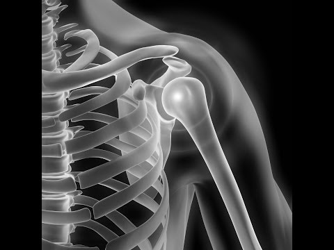 Rückenschmerzen im Lendenwirbelbereich ziehen das Bein Tibetische Gymnastik in Osteochondrose Video