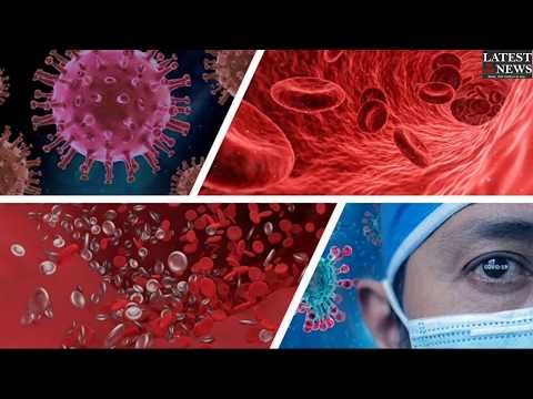 Thick Blood clots in COVID-19 patients: Doctor scares Thick Blood clots in COVID-19 patients: Doctor scares