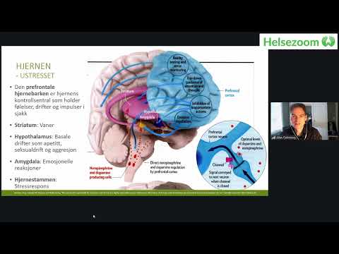 Slik roer du amygdala – 11 tips til mindre stress