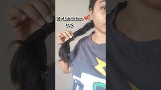 Hair Growth serum✨ Full Details in description 😇#haircare #hairfall #hairgrowth #hairtips #journey