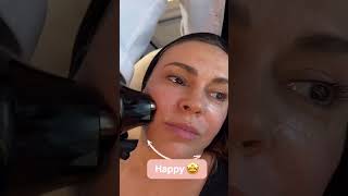 Milano Alyssa's secret to her lifted look: #triLift 👏🏼⁠  #skincare #beauty #beautytreatments