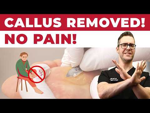 HUGE Foot PIMPLE filled with dead FAT Crystals