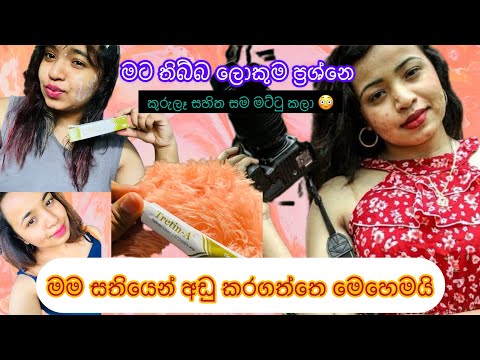 ☑️Best Acne & Pigmentation Removal Cream | Tretin-A Tretinoin Cream Review | Beauty with Gauri