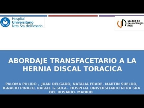 Hernia discal torácica