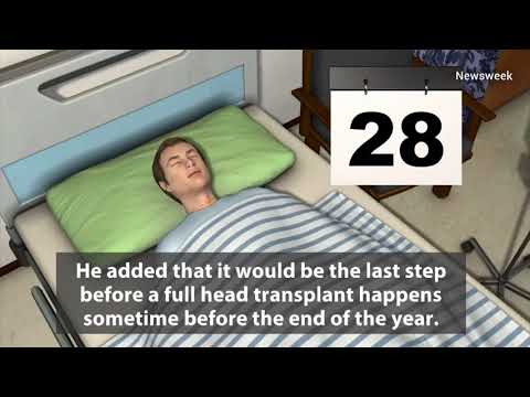 WATCH: Professor Says First Successful Human Head Transplant Using Cadavers Performed