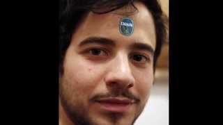 OGGI CHI SONO parte 1 - Management Del Dolore Post-Operatorio