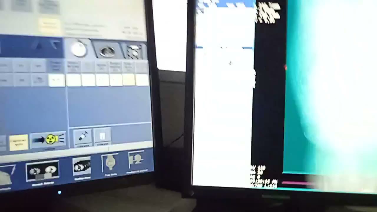 GE,CT 16 cortes adquisición estudio simple y contrastado primera parte