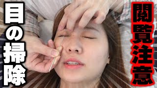 【閲覧注意】怖かったけど爽快！眼球洗浄に行ってみた