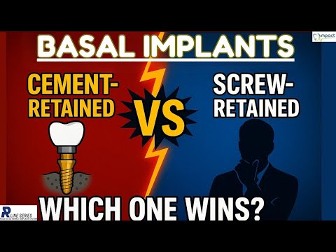 ✅ Basal Implants: Cement vs Screw Retained — The Ultimate Showdown! 🦷