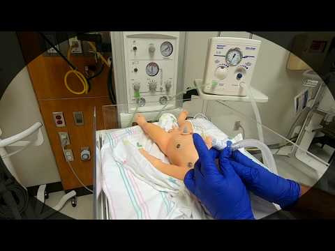 SAILing through the MIST: sustained lung inflation and surfactant therapy in neonatal resuscitation