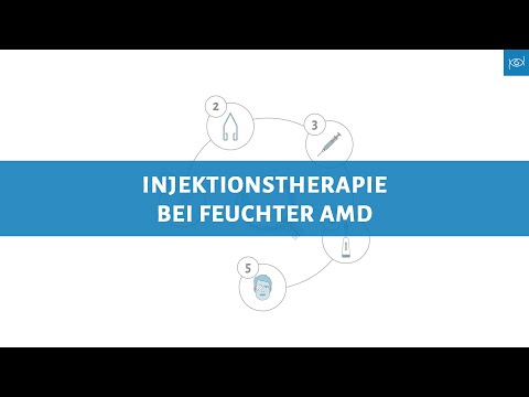Injektionstherapie bei feuchter altersbedingten Makuladegeneration   feuchte AMD  - Erklärvideo