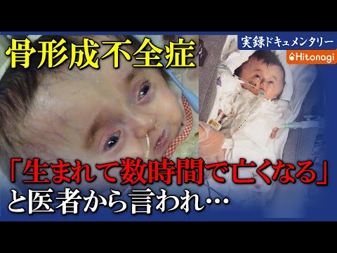 ラーセン症候群