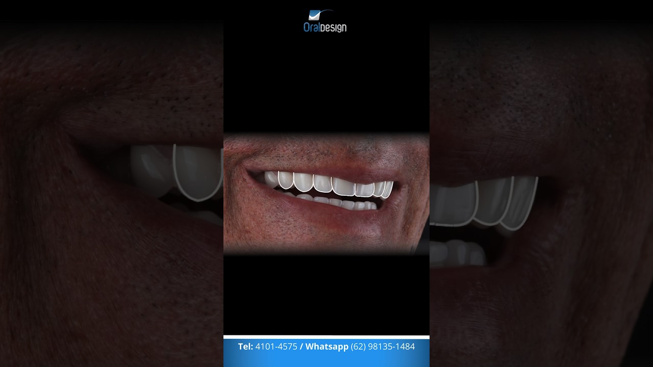 Danilo Monteiro Rezende Pereira-38