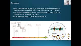 Cardiopatía isquémica (Parte 2)