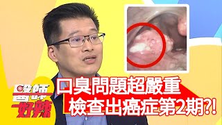 口臭問題超嚴重！醫師一看：癌症第2期！【#醫師好辣】20210308 part3 EP1110 吳昭寬 洪素卿