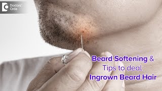 INGROWN BEARD HAIR | Ingrown facial hair in MEN |Causes & Treatment -Dr. Nischal K | Doctors