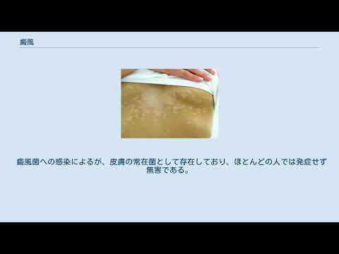 癜風コニュアについて詳しく解説