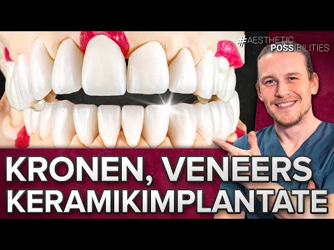 Keramikzahnimplantate + Veneers und Kronen versorgt! Ober- und Unterkiefer Smile Makeover 🦷