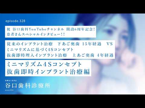 第328話 上アゴ奥歯のミニマリズム・インプラント患者さんインタビュー谷口歯科YouTube６周年記念-従来のインプラント治療と比べてのご感想とは⁉️