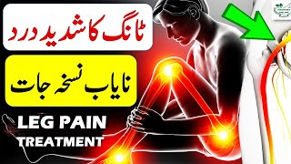 Leg Pain Signs And Symptoms | How To Get Rid Of Leg Pain Without Surgery |Tango Ke Dard Ka Ilaj