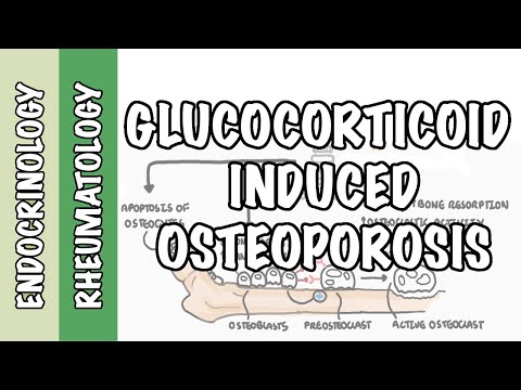 Glucocorticoid Induced Osteoporosis and Fractures - Mechanism and Pathophysiology of Fractures