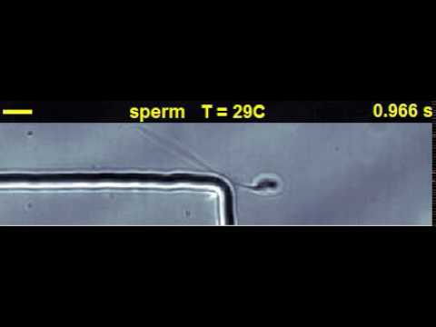 Spermatozoa turns around a sharp corner